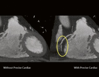 Foto: Philips | Precise Cardiac