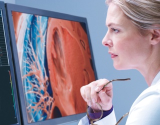 Foto: Philips | IntelliSpace Portal