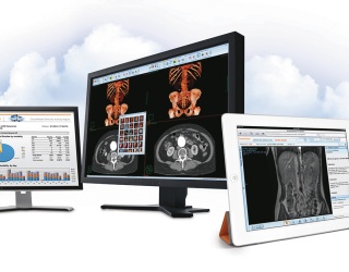 Foto: Philips | Vue Beyond