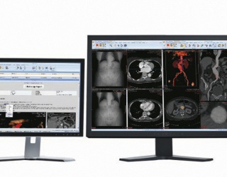 Foto: Philips | Vue Reporting