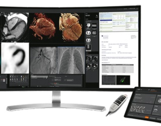 Foto: Siemens Healthineers | Syngo Carbon