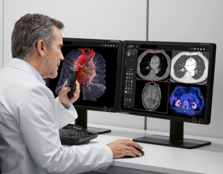 Foto: Siemens Healthineers | syngo.via