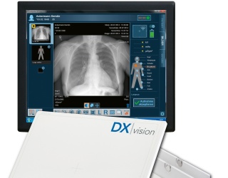 Foto: medigration | DR-Retrofi t-Kit DX | Vision...