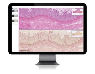 Foto: INFINITT | Digital Pathology Solution