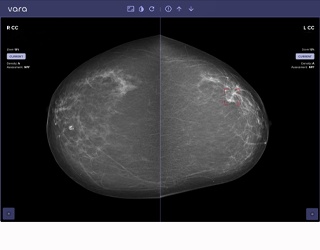 Foto: Pünktlich zum Brustkrebsmonat Oktober: Radiologische Allianz setzt...
