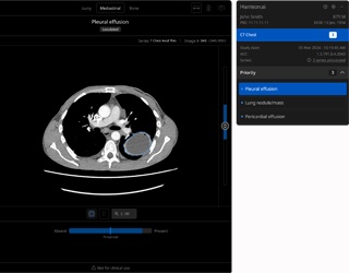 Harrison.ai präsentiert fünf Innovationen