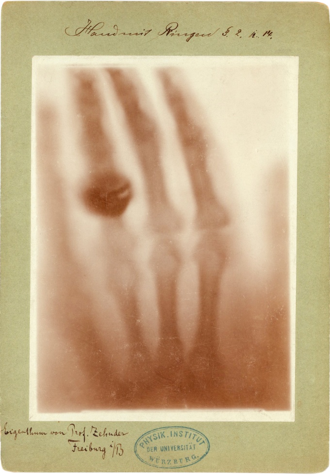 Durchleuchtung einer menschlichen Hand mit Ringen, 22. Dezember 1895 (C)DRG...