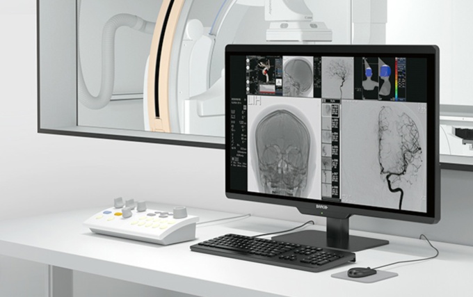 Niedrige Dosis und diagnostische hochwertige Bilder sind Eigenschaft en von...