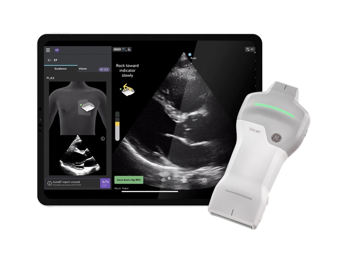 Foto: Wie neue Ultraschallsysteme die Radiologie verändern...