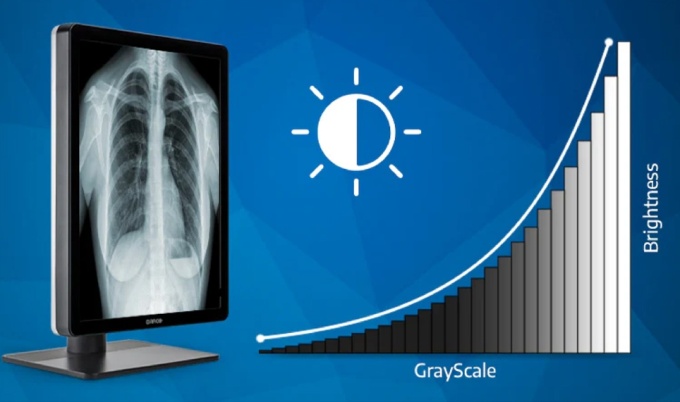 Die DICOM-GSDF (Grayscale Standard Display Function) ist ein Standard zur...