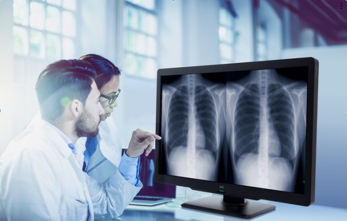Foto: Displays von der Radiologie bis zur Fernbefundung...