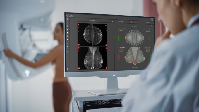 Foto: Strategische Partnerschaft für präzisere Brustkrebsdiagnostik...