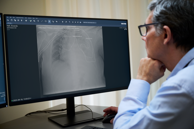 Sectra übernimmt Oxipit