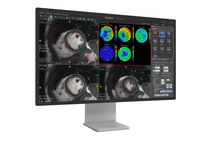 Foto: TeraRecon ⎮ AV