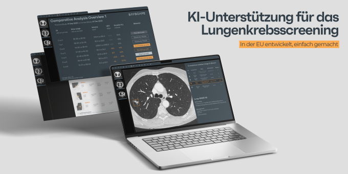 Rayscape Lung CT