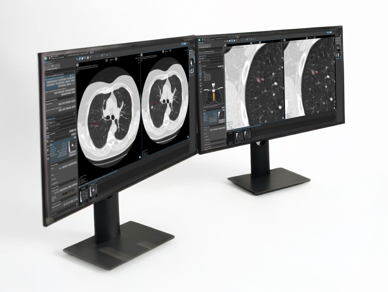 Lcsc Radiography LCS: Entdecke die Magie der Details - RadMag - Online-Journal für die ...