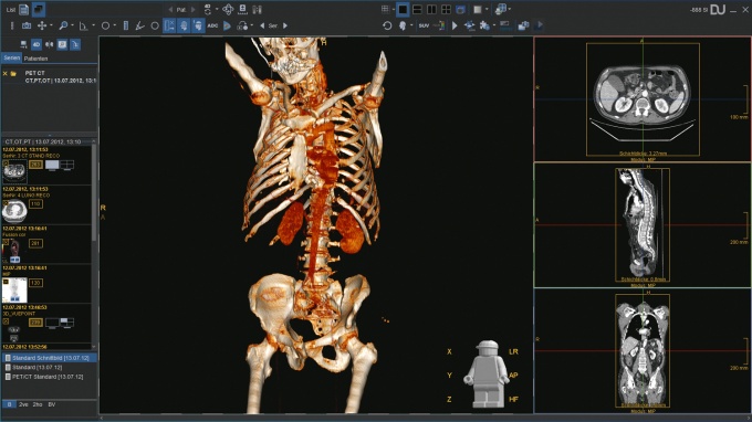 Foto: Dedalus HealthCare | DeepUnity Diagnost & DICOM Services...