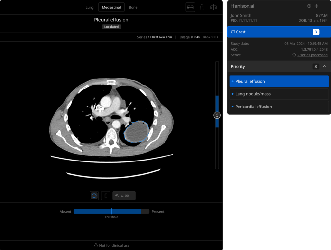 Lung-CT