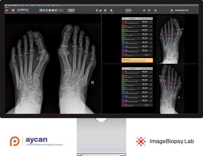 aycan und Imaging Biopsy Lab