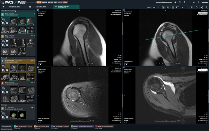Foto: Dedalus HealthCare | DeepUnity PACSonWEB