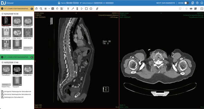 Foto: Dedalus HealthCare | DeepUnity Viewer