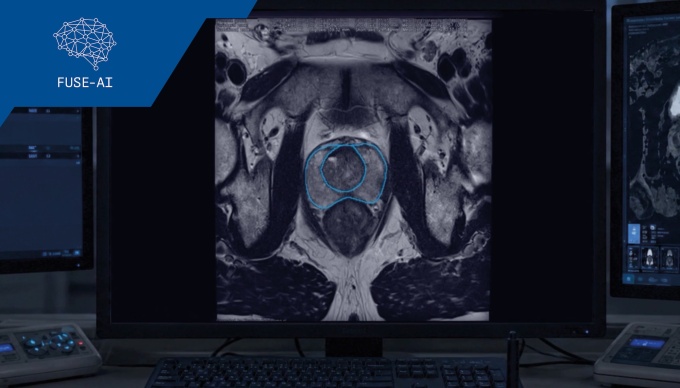 Prostata-MRT: KI von FUSE-AI verbindet hohe Präzision mit deutlichem Zeitgewinn...