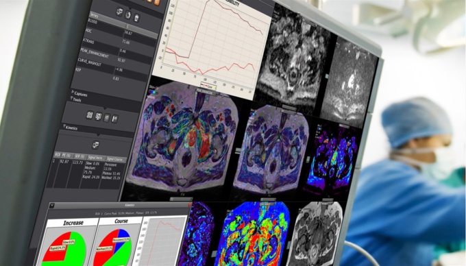 Foto: Canon Medical | Vitrea Advanced Visualization...