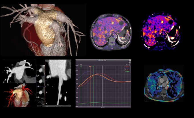 Foto: Canon Medical | Vitrea Extend