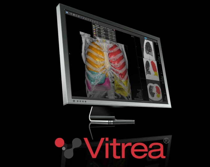 Foto: Canon Medical | Vitrea Workstation