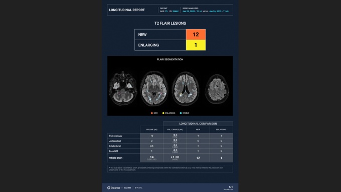 Foto: Gleamer | MRNeuroMS