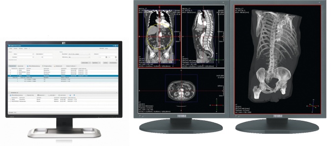 Foto: Nexus Enterprise Imaging | RVC RIS