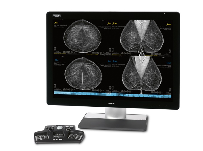Foto: HOLOGIC | 3DQuorum Technologie