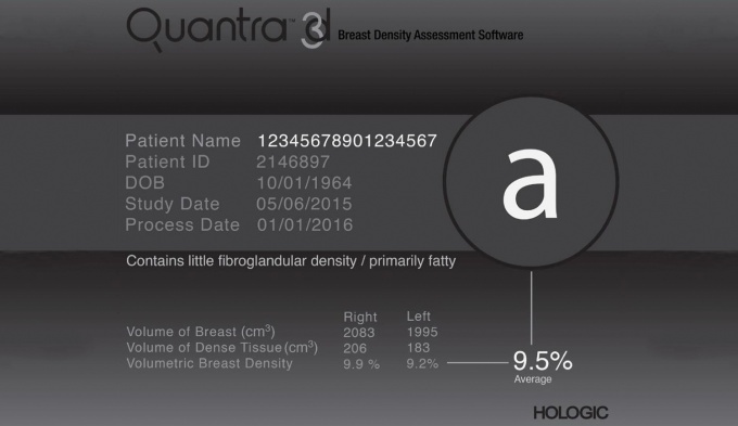 Foto: HOLOGIC | Quantra