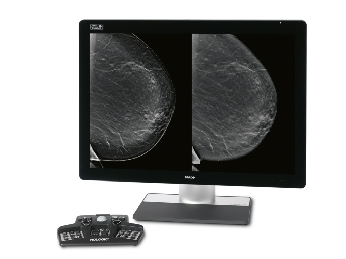 Foto: HOLOGIC | Intelligent 2D Bildgebungstechnologie...