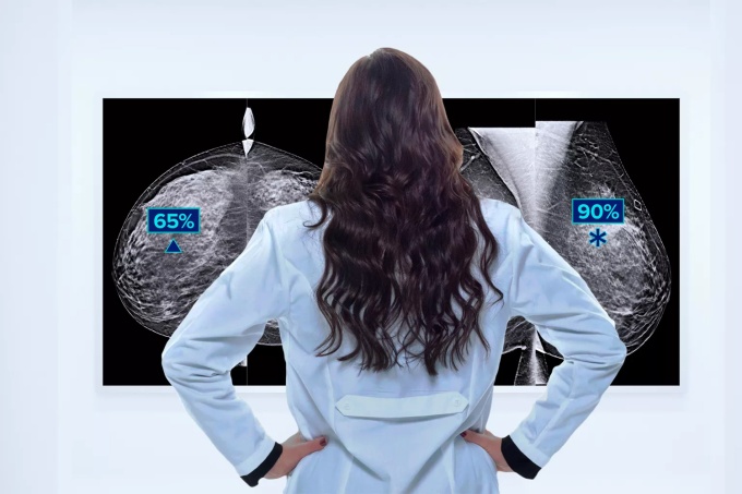 Foto: HOLOGIC | Genius AI Detection