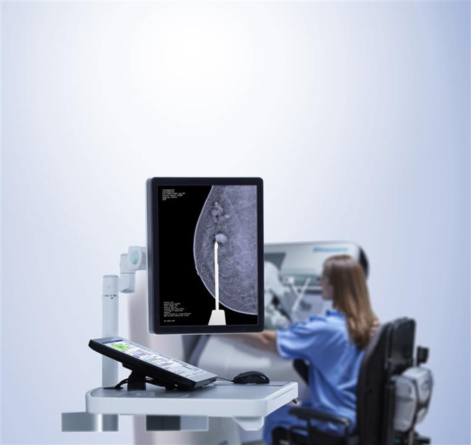 Foto: HOLOGIC | Affirm Contrast Biopsy Software...
