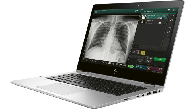 Foto: Fujifilm | FDR go flex