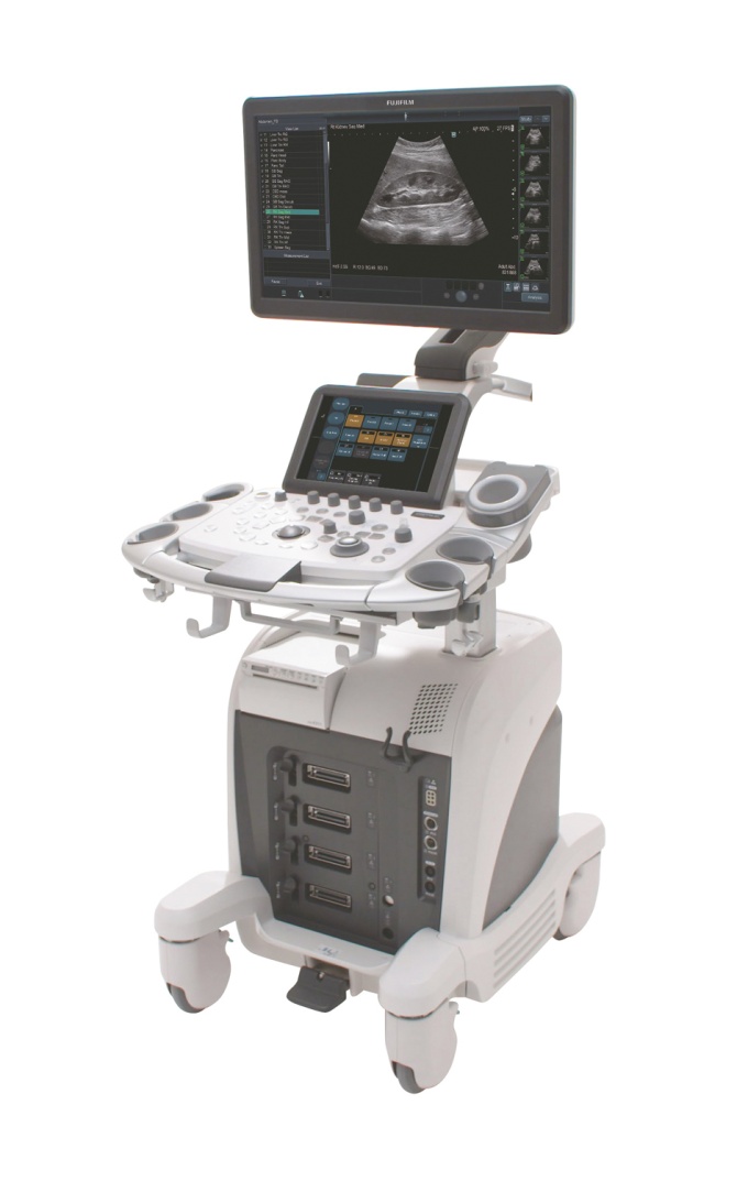 Foto: Fujifilm | ARIETTA 65 Intuitive Fusion