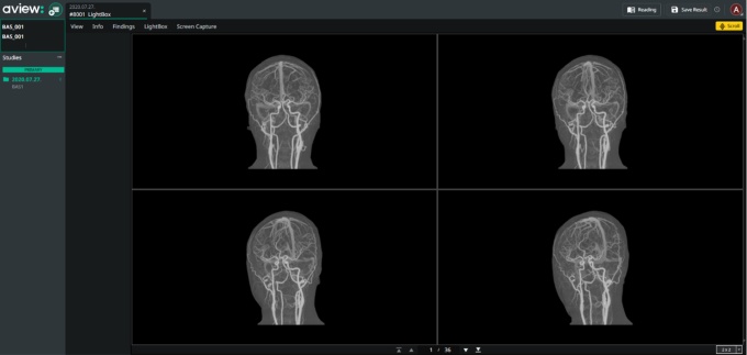 Foto: Coreline | aview BAS