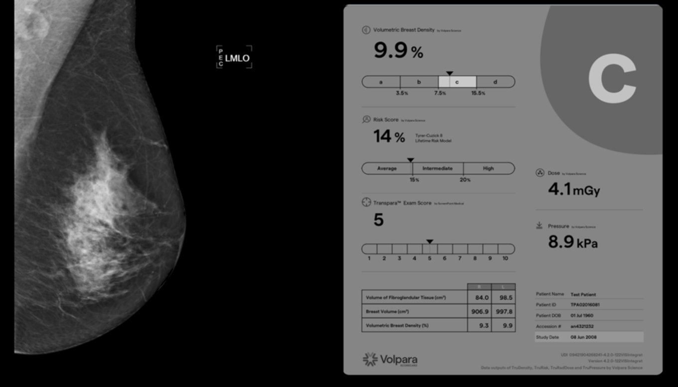 Volpara Lunit | Volpara - RadMag - Online-Journal für die Radiologie @ RadMag ...