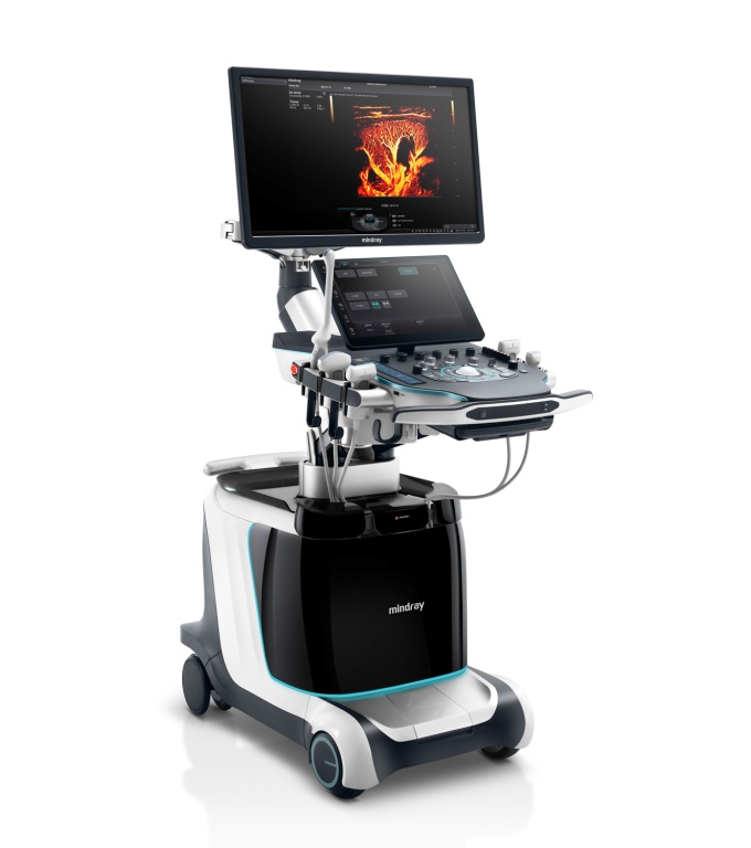 Foto: Mindray | Resona A20