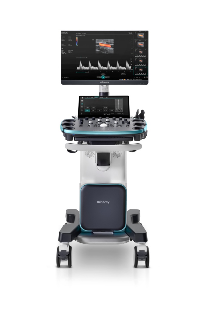 Foto: Mindray | Resona I8