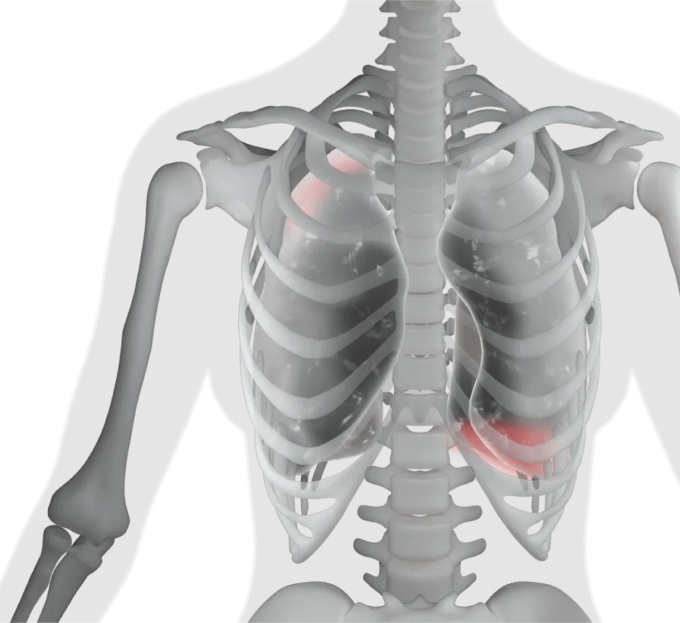 Foto: Injecto Med | AZmed · AZchest