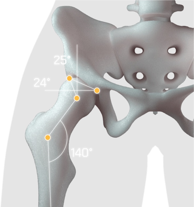 Foto: Injecto Med | AZmed · AZmeasure