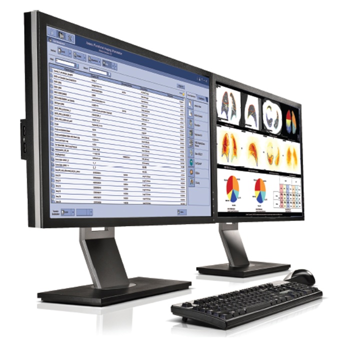 Foto: GE HealthCare | Xeleris V & Xeleris 4DR
