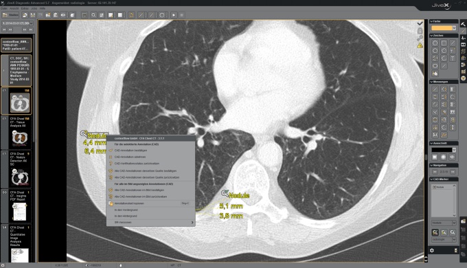 Foto: Visus Health | JiveX KI-Workflow