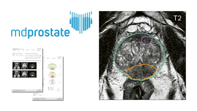 Foto: mediaire | mdprostate