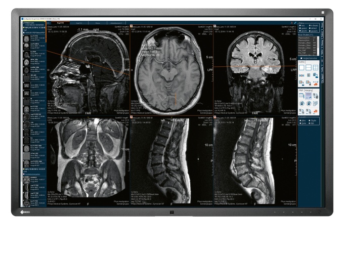 Foto: medigration | ImageVision