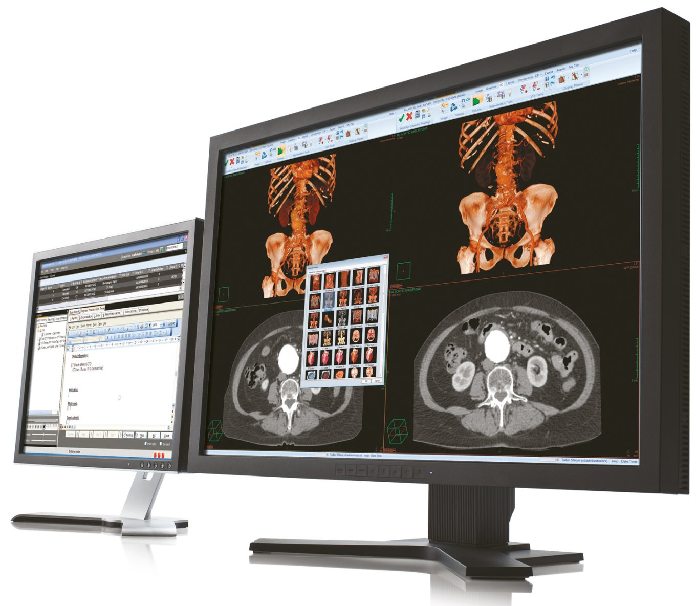 Philips | Vue PACS - RadMag - Online-Journal für die Radiologie ...