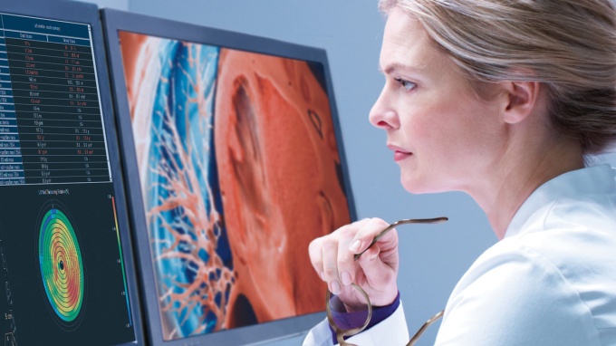 Foto: Philips | IntelliSpace Portal